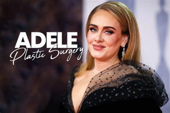 Adele Plastic Surgery: Her New Look Sparks Plastic Surgery Speculation!