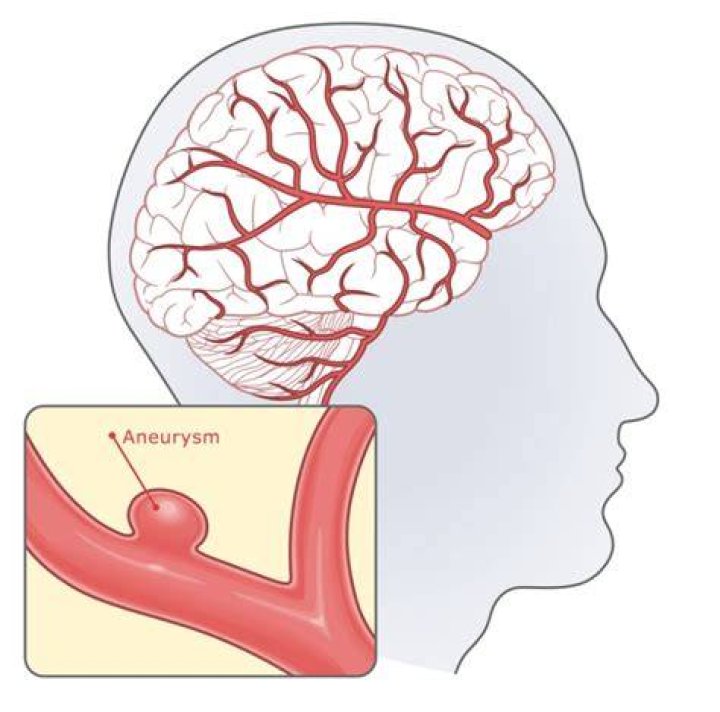 Amanda Abarbanel-Rice Dies of Ruptured Brain Aneurysm
