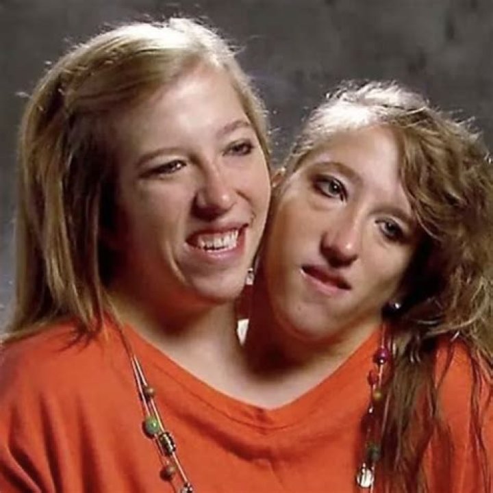 Are Abby And Brittany Hensel On Instagram? – Celebrity