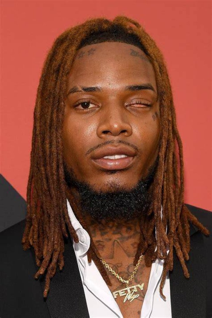 Can Fetty Wap Fix His Eye? – Celebrity