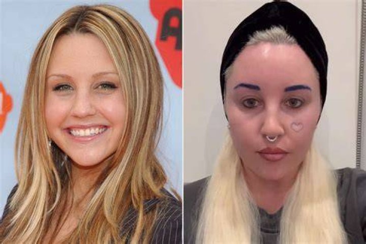 Did Amanda From Top Model Go Blind? – Celebrity