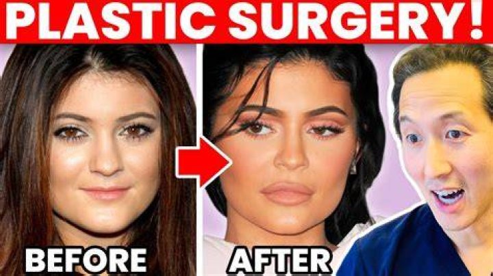 Has Putin done plastic surgery? Is Putin ill?