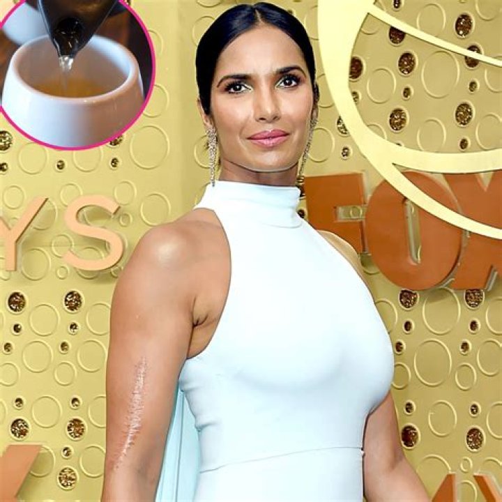 How did Padma Lakshmi get her scar?