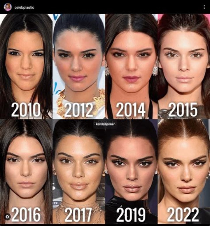 Kendall Jenner Opens Up About Plastic Surgery: 'It does not even make sense'