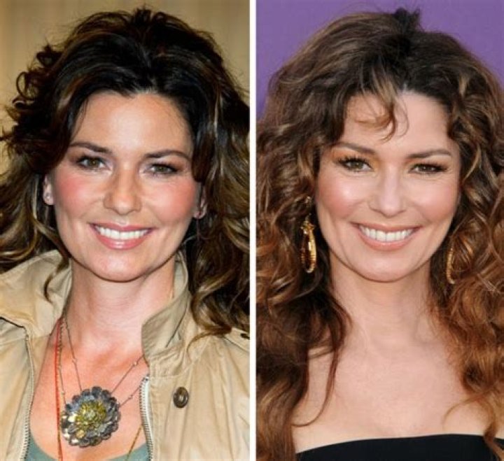 Shania Twain Plastic Surgery: Her Approach of Embracing or Altering Herself?