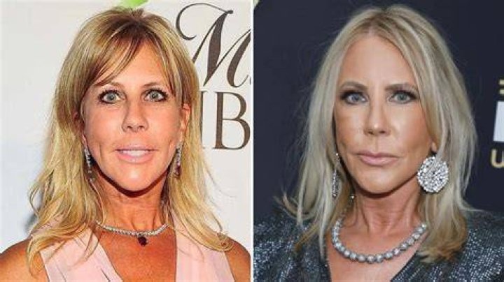 Vicki Gunvalson Says Her New Podcast & Reality Show Will Feature Her ‘Real Life’ Compared To ‘Fake’ RHOC