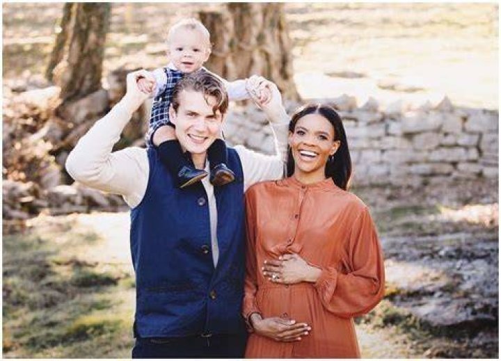 Who is Candice Craig? Wikipedia, age, husband, daughter, before surgery, Instagram, net worth