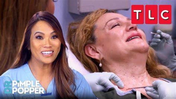 Who Was Brittany Sharp On Dr. Pimple Popper? – Celebrity