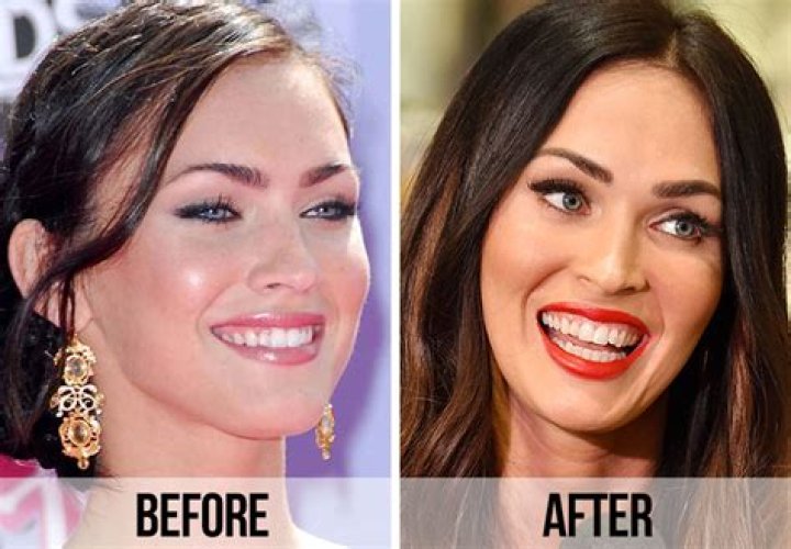 Why Do Redheads Have Yellow Teeth? – Celebrity